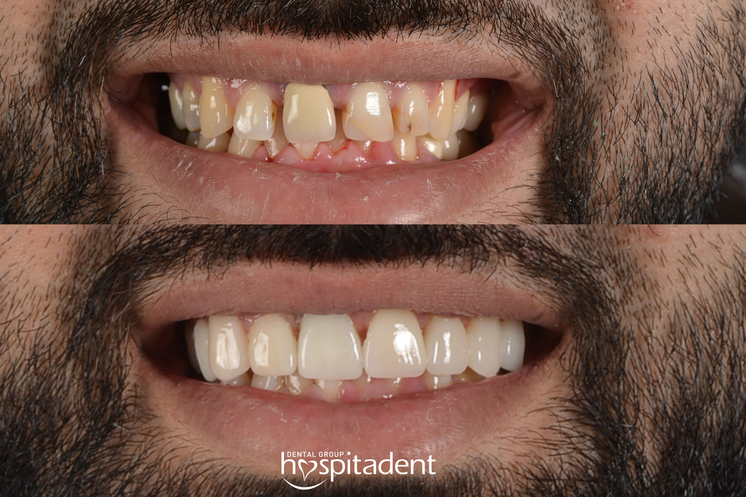 Hollywood Smile — Hospitadent