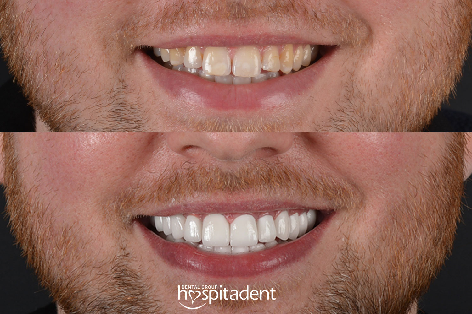 Hollywood Smile — Hospitadent