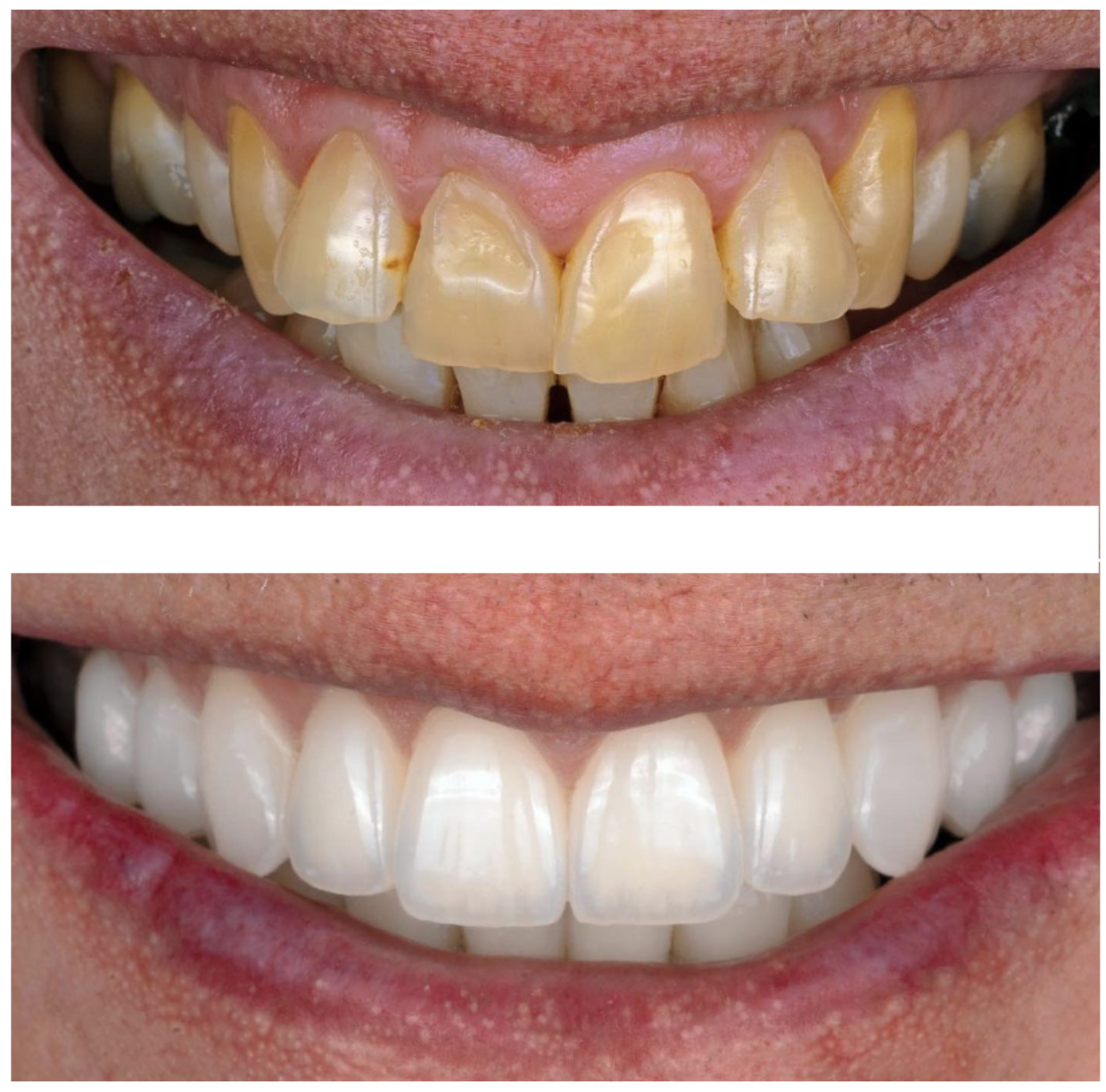 Couronnes Dentaires — Swiss dental