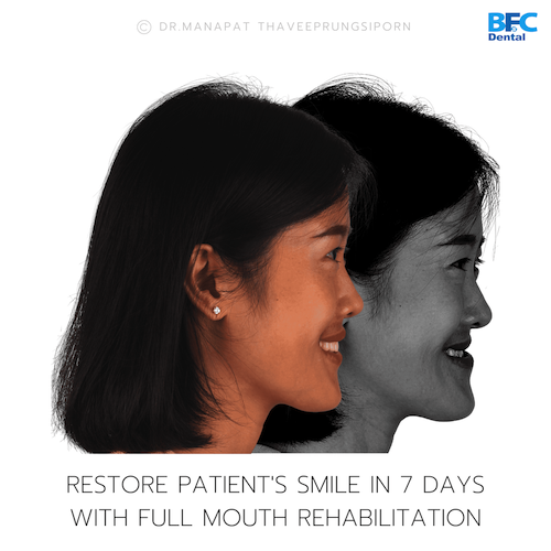 Reconstruction Totale — BFC Dental