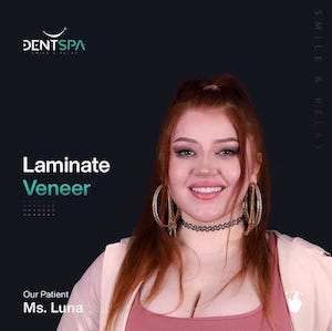 Facettes Emax — DentSpa Clinic