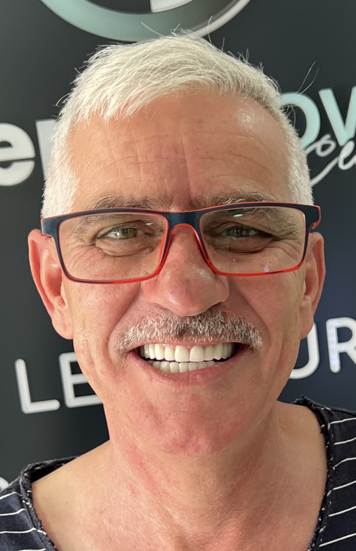 Corone zirconio — Dentglow