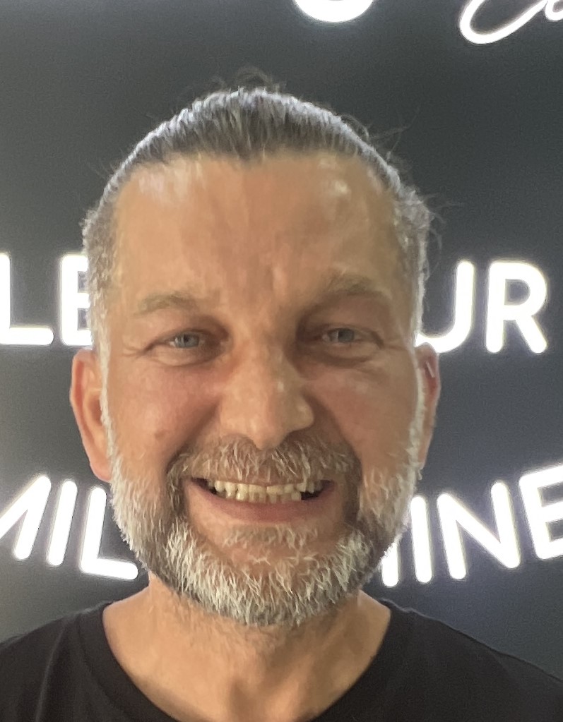 Corone zirconio — Dentglow