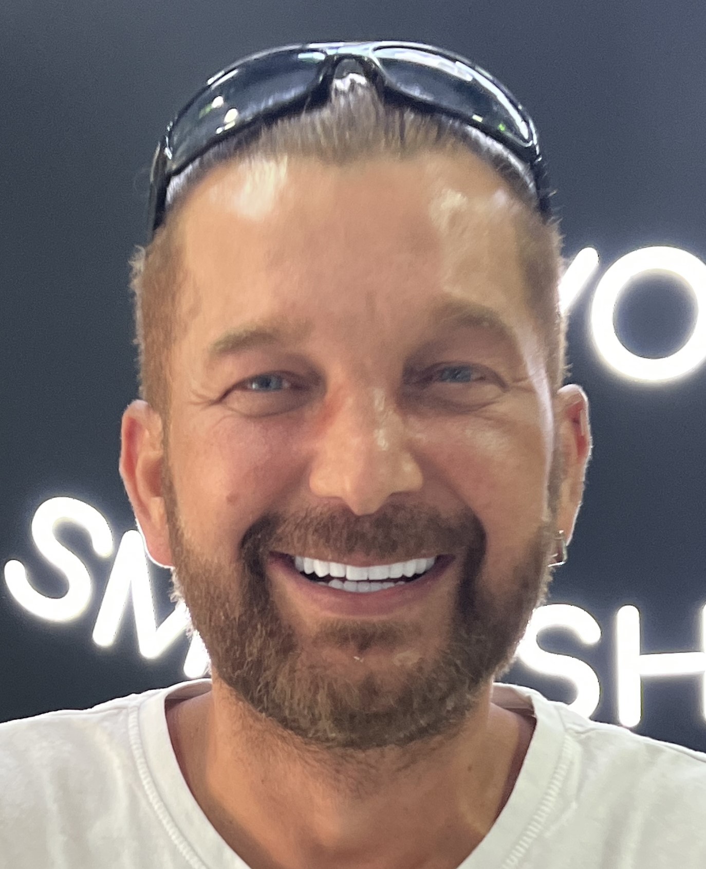Corone zirconio — Dentglow