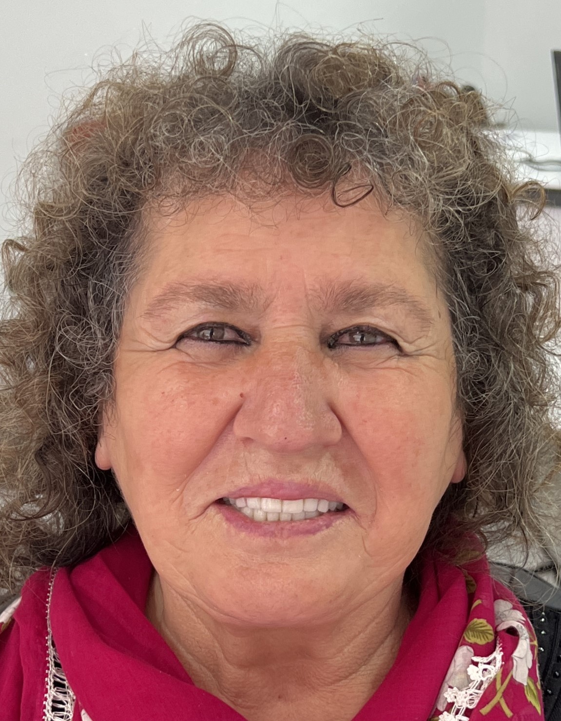 Corone zirconio — Dentglow
