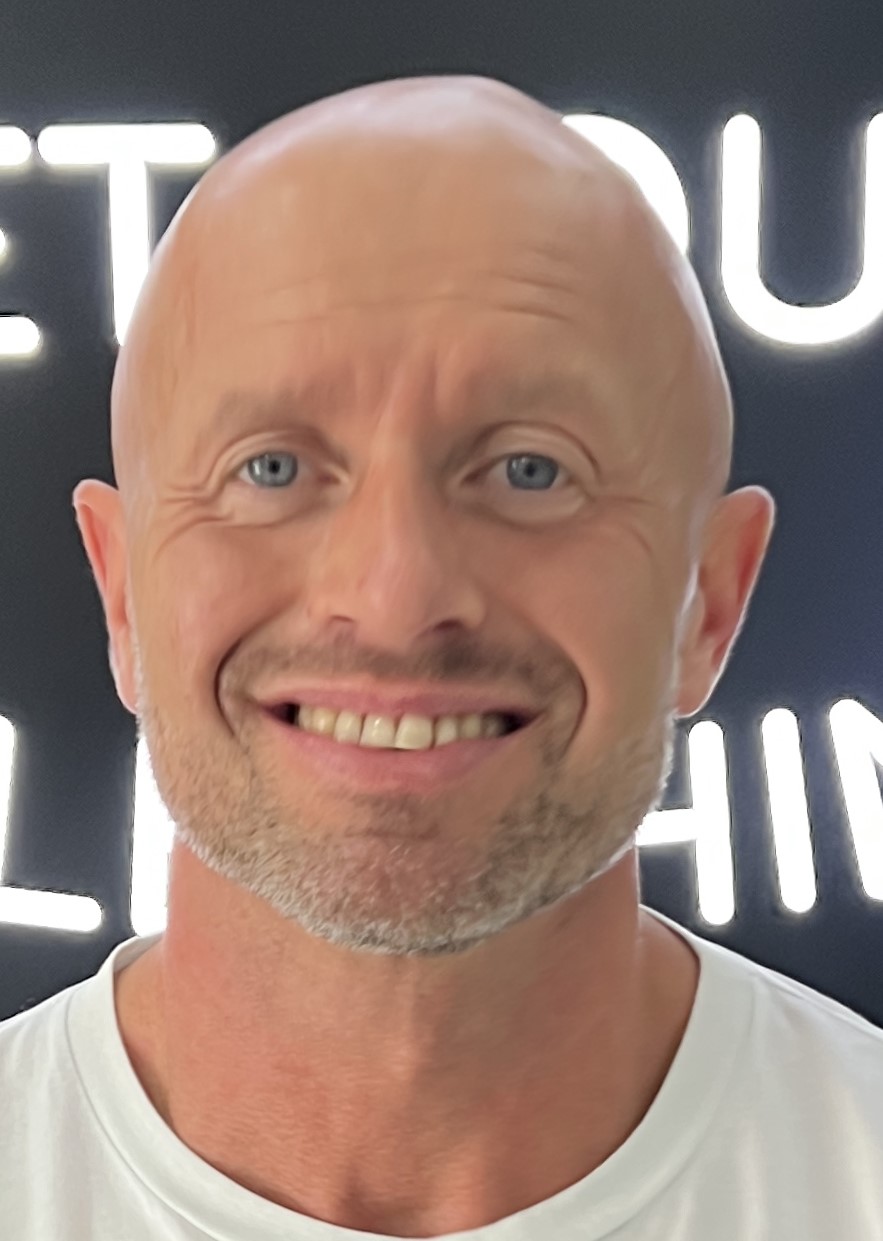 Corone zirconio — Dentglow