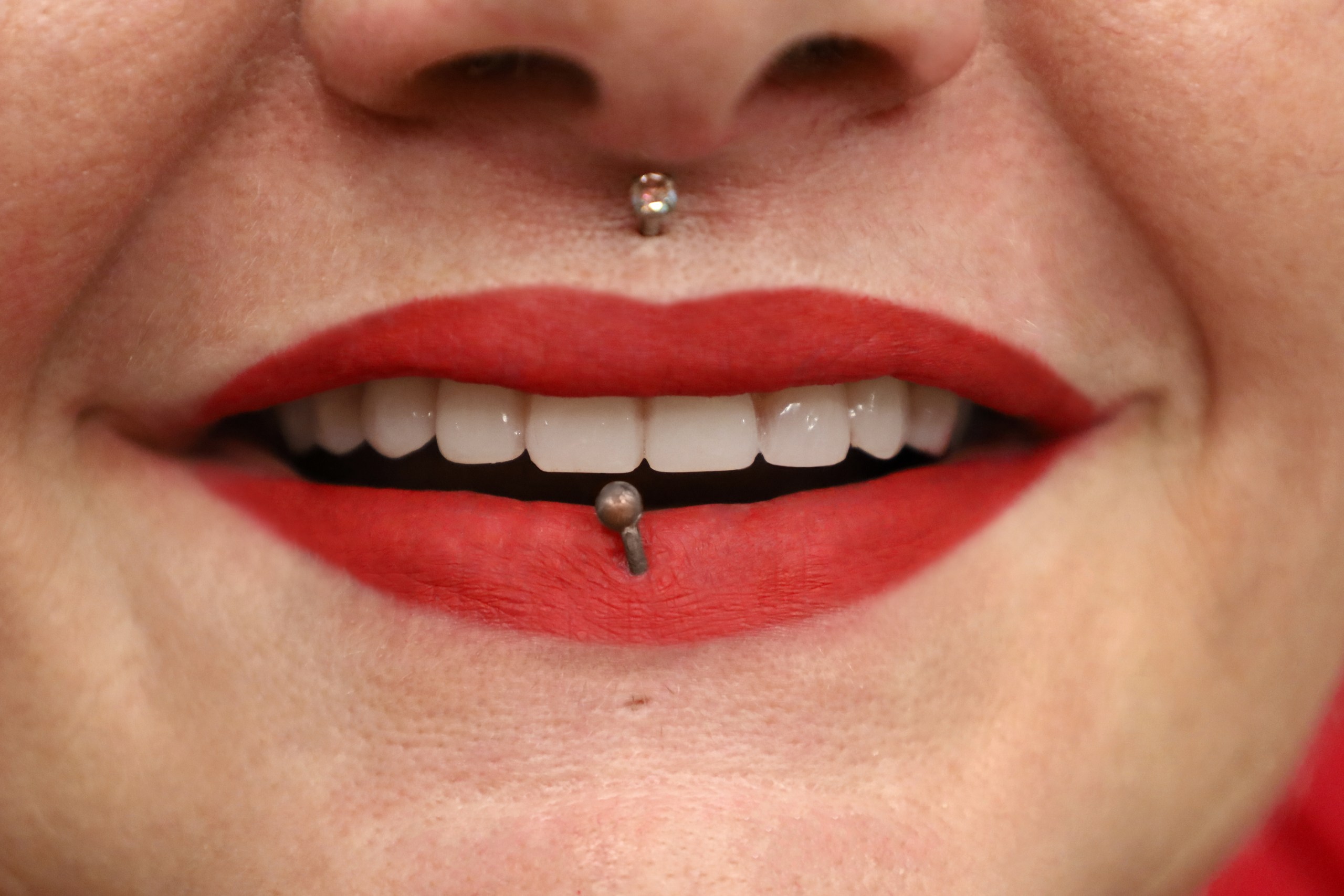 Implants Straumann — WestDent Clinic