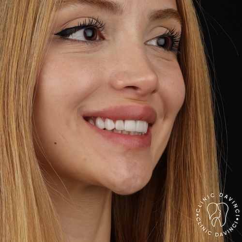 Hollywood Smile — Clinique Davinci