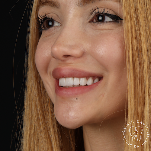 Hollywood Smile — Clinique Davinci