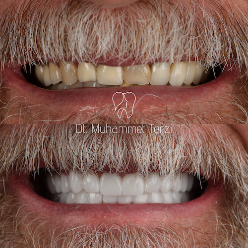 Hollywood Smile — Clinique Davinci