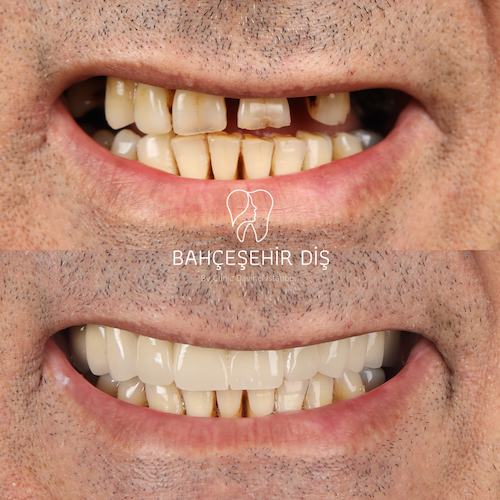 Hollywood Smile — Clinique Davinci