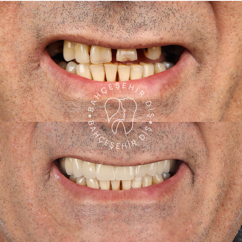 Hollywood Smile — Clinique Davinci