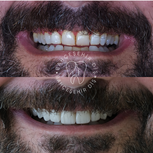 Hollywood Smile — Clinique Davinci