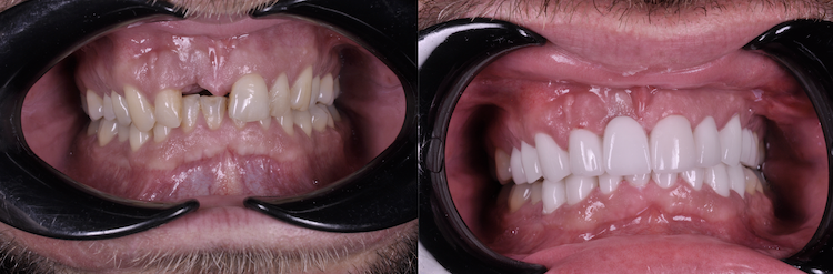 Hollywood Smile — Dentapoint