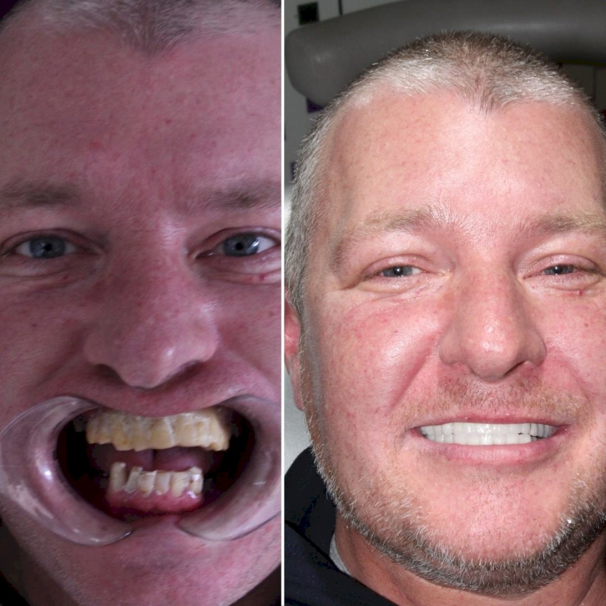 Implants Dentaires — Ephesus global dental