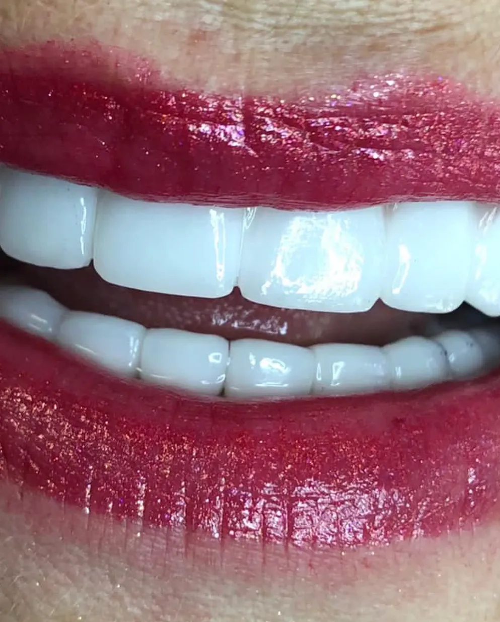Couronnes Dentaires — Dental Med Austria