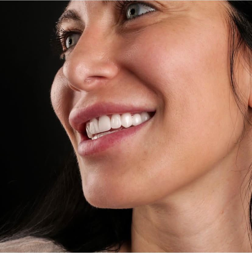 Hollywood Smile — HealthPointWorld