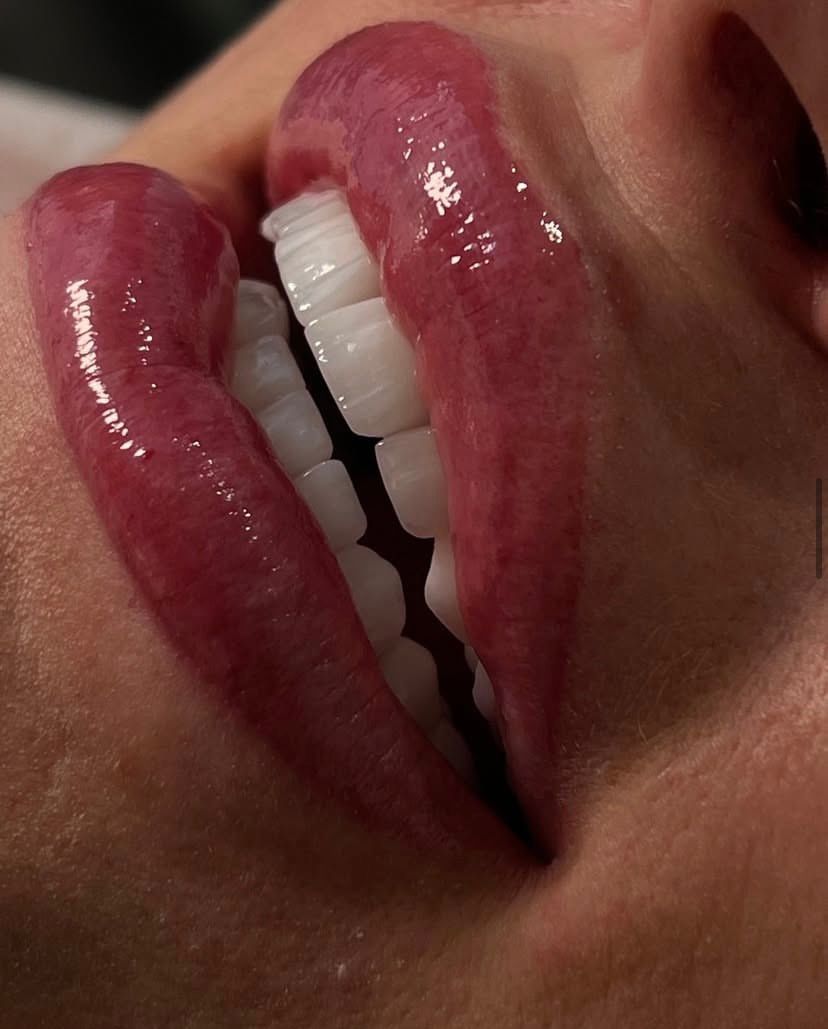 Hollywood Smile — HealthPointWorld