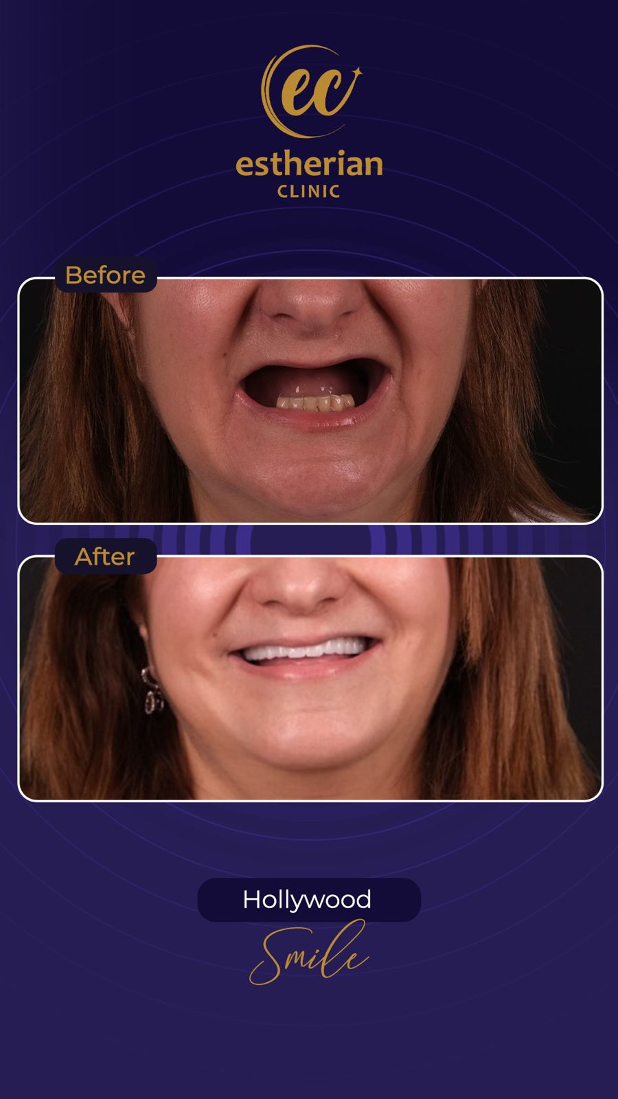 Reconstruction Totale — Estherian clinic
