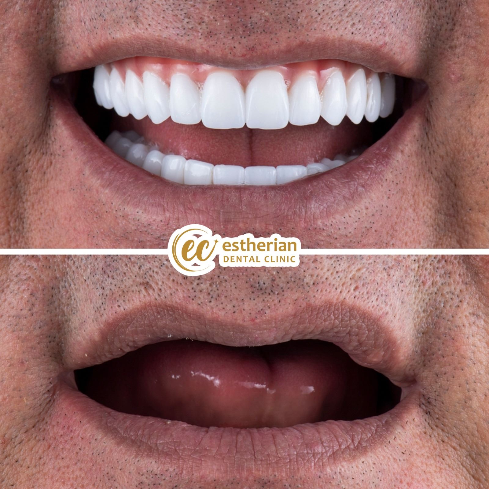 Reconstruction Totale — Estherian clinic