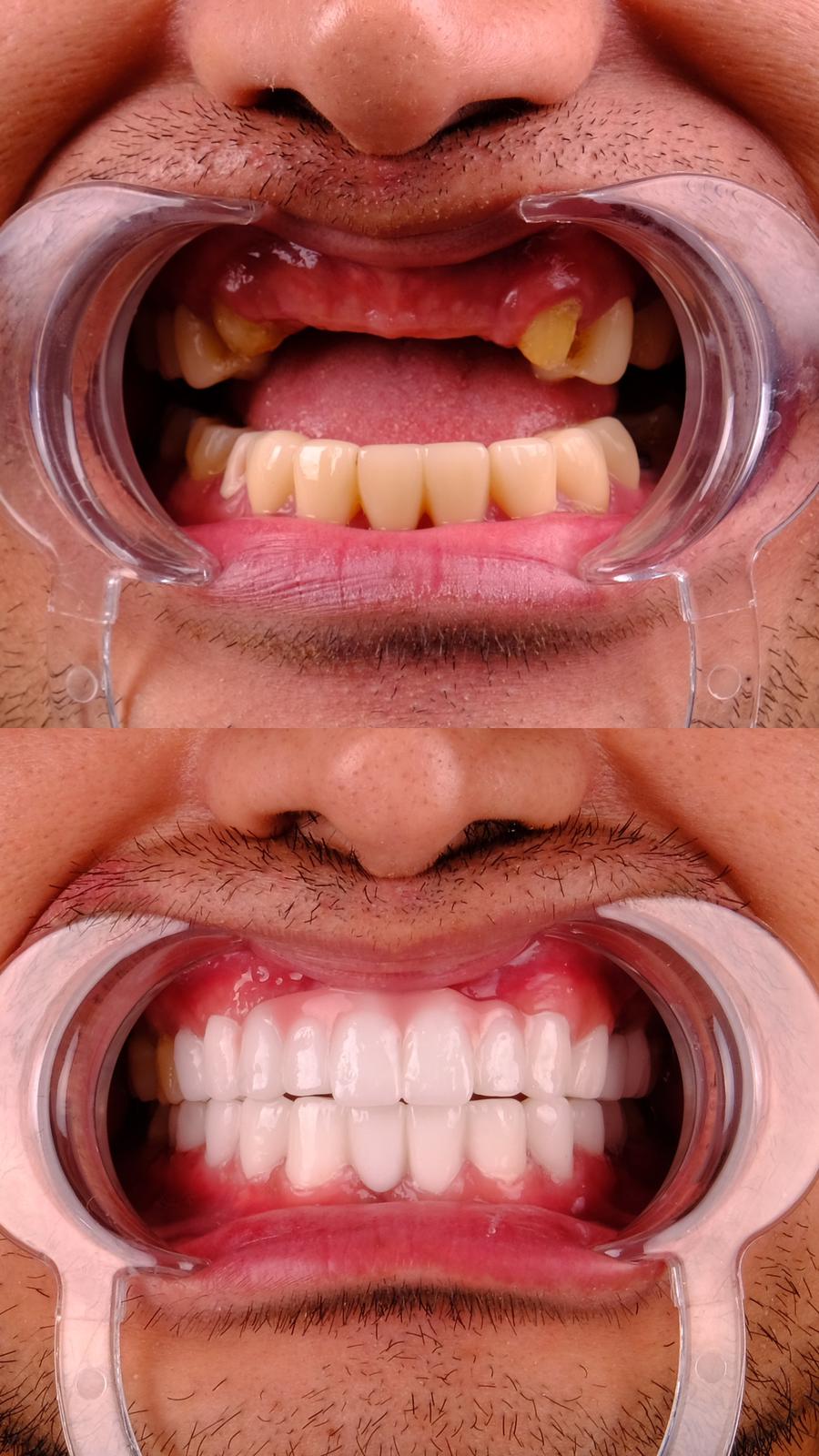 Reconstruction Totale — Estherian clinic