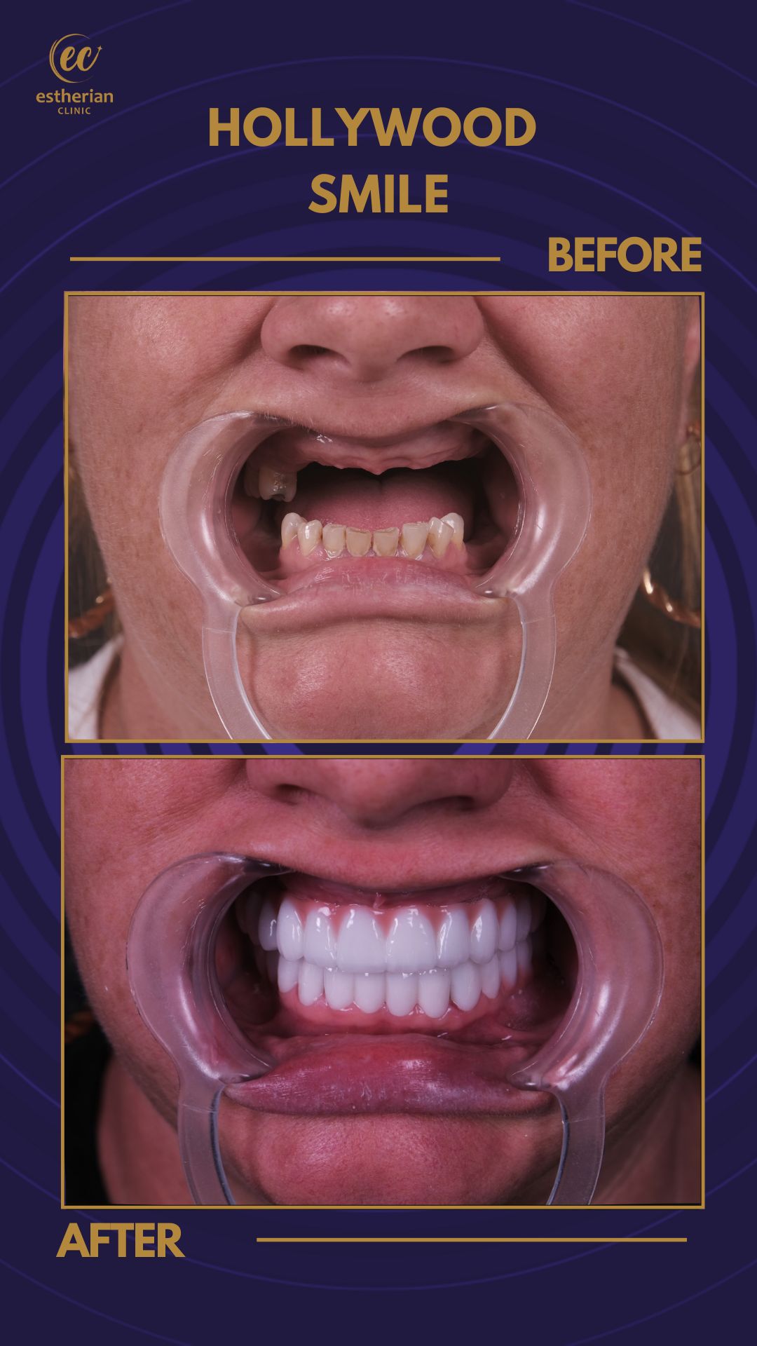 Reconstruction Totale — Estherian clinic