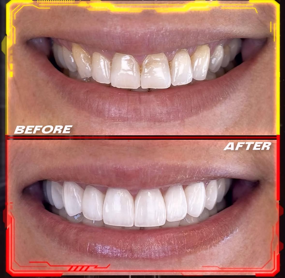 Couronnes Dentaires — Cronos Dental & Medical Clinic
