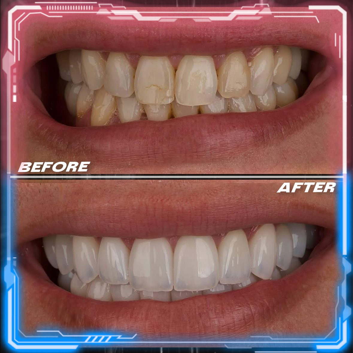 Couronnes Dentaires — Cronos Dental & Medical Clinic