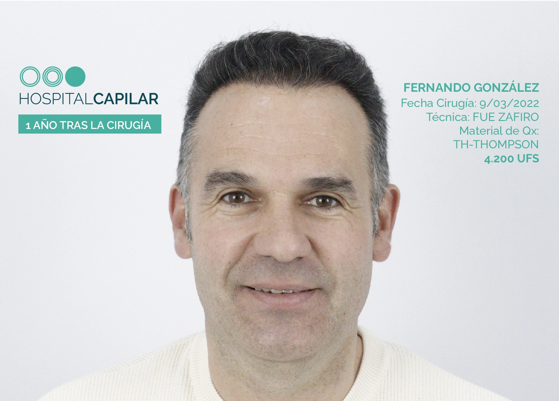 FUE — Hospital Capilar Madrid