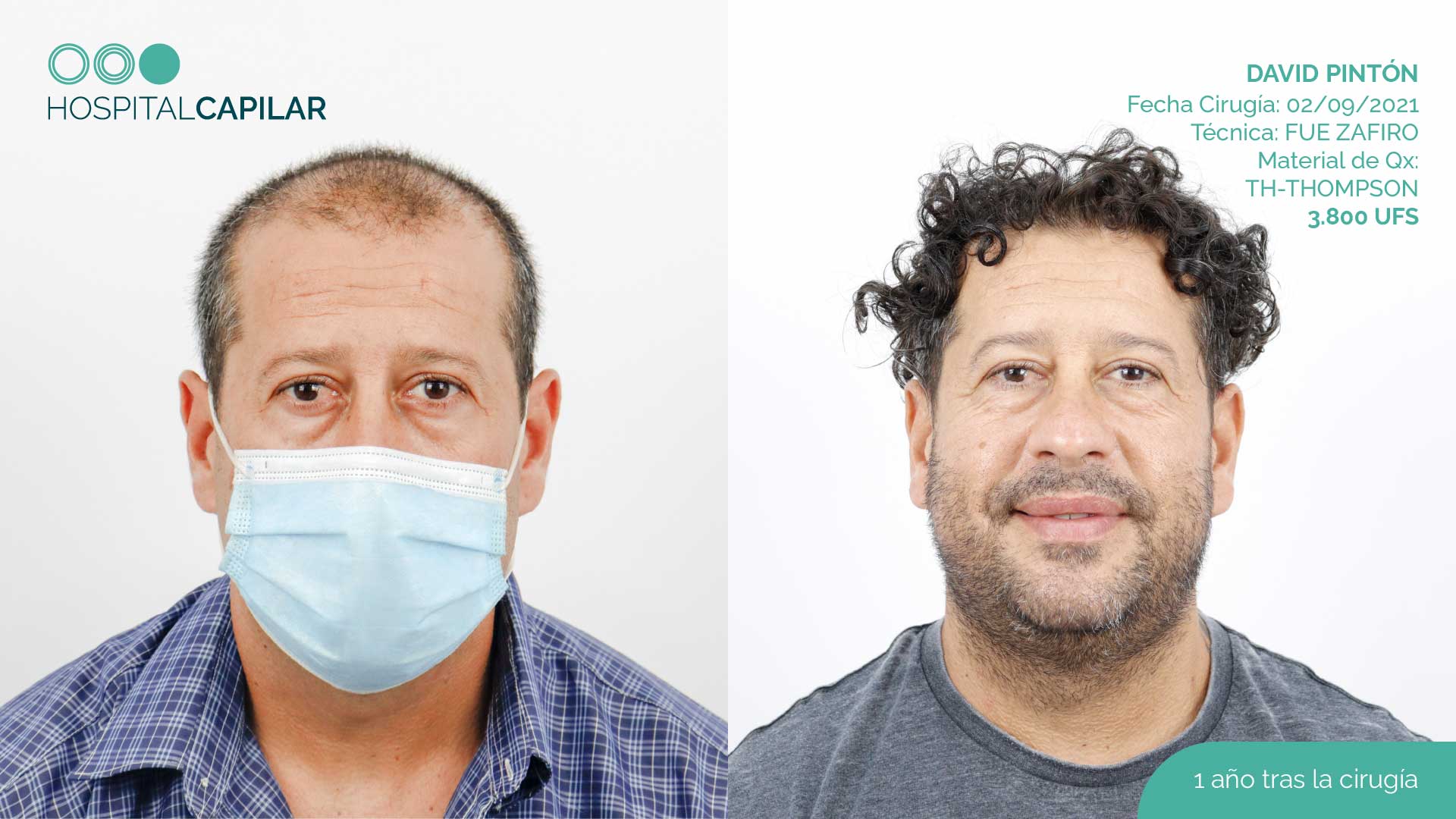 DHI — Hospital Capilar Madrid