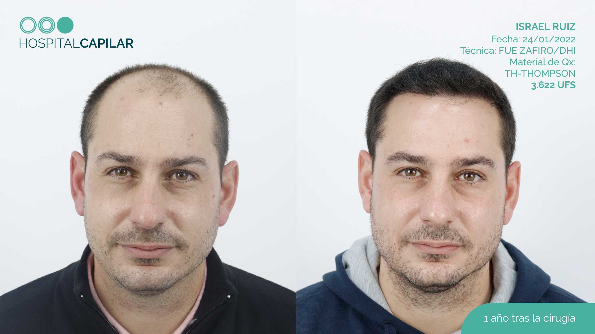 DHI — Hospital Capilar Madrid