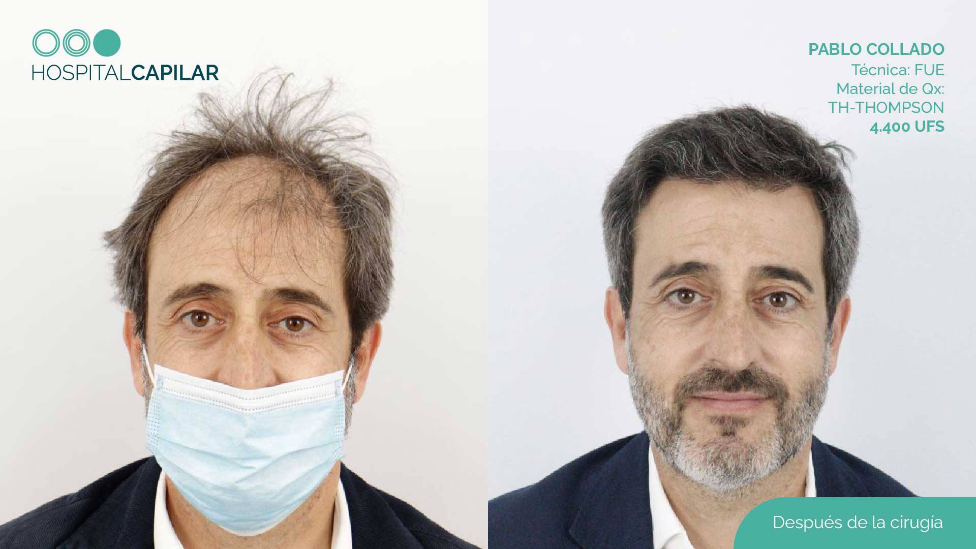 DHI — Hospital Capilar Madrid