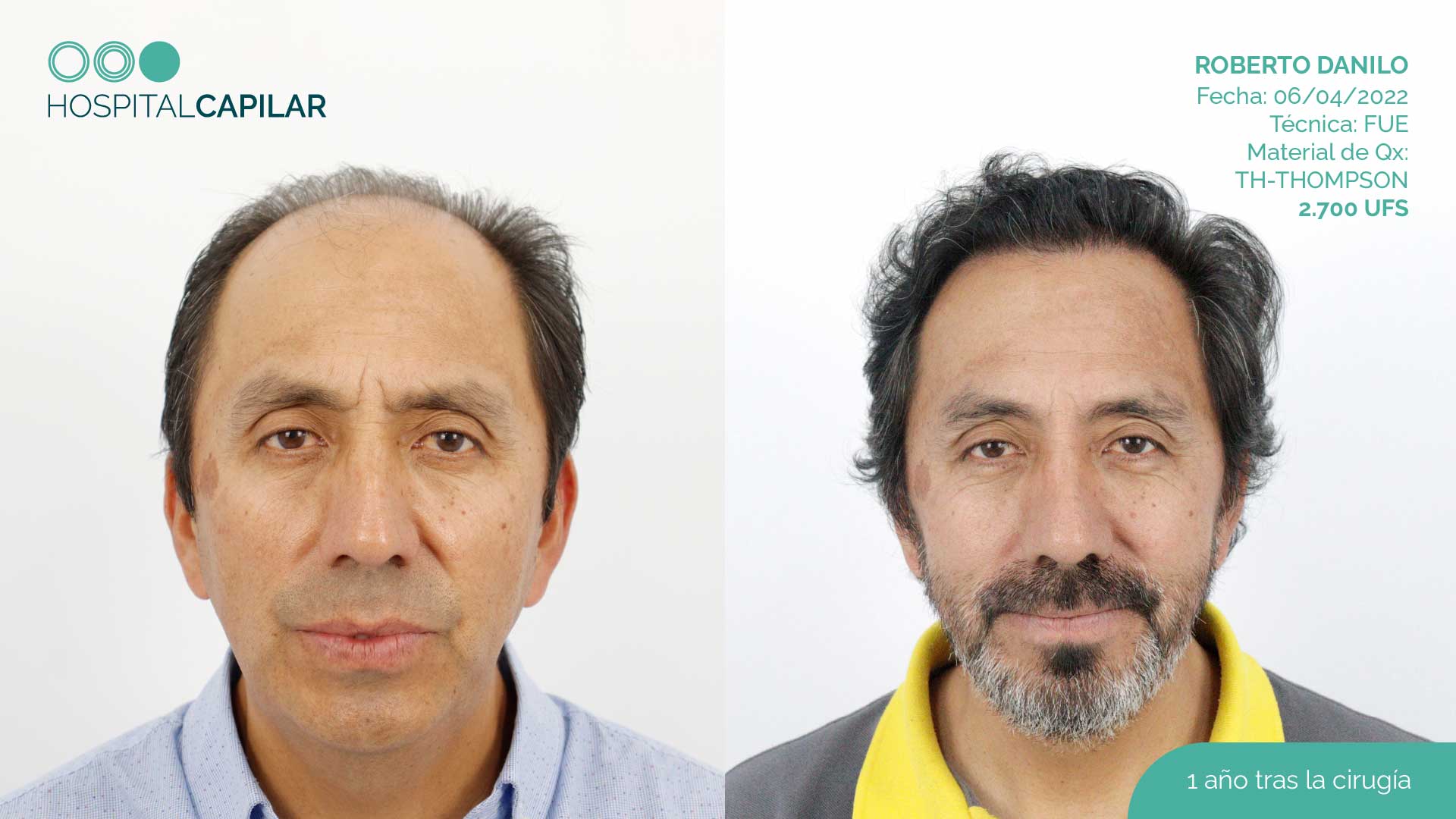 DHI — Hospital Capilar Madrid