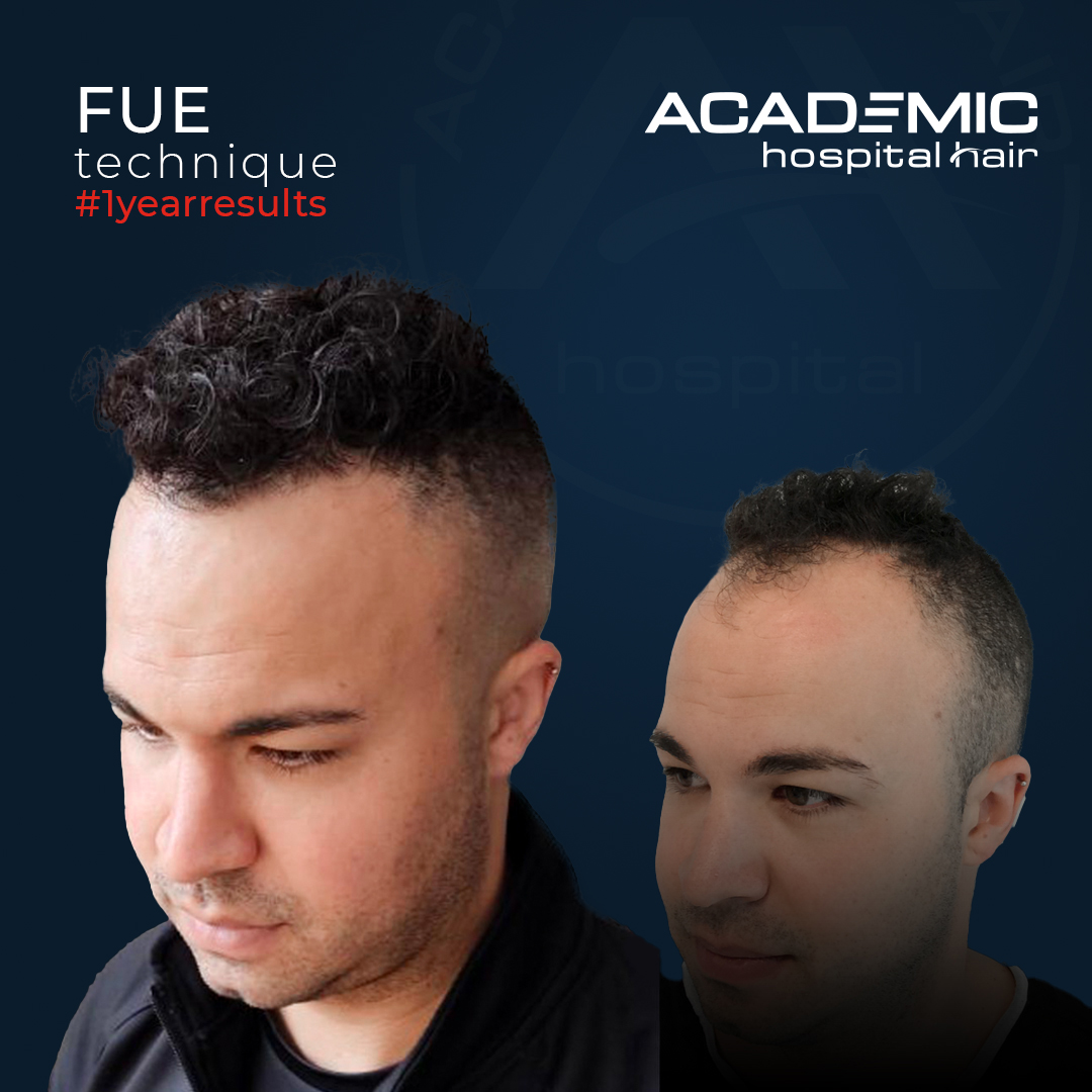 FUE — Academic Esthetics