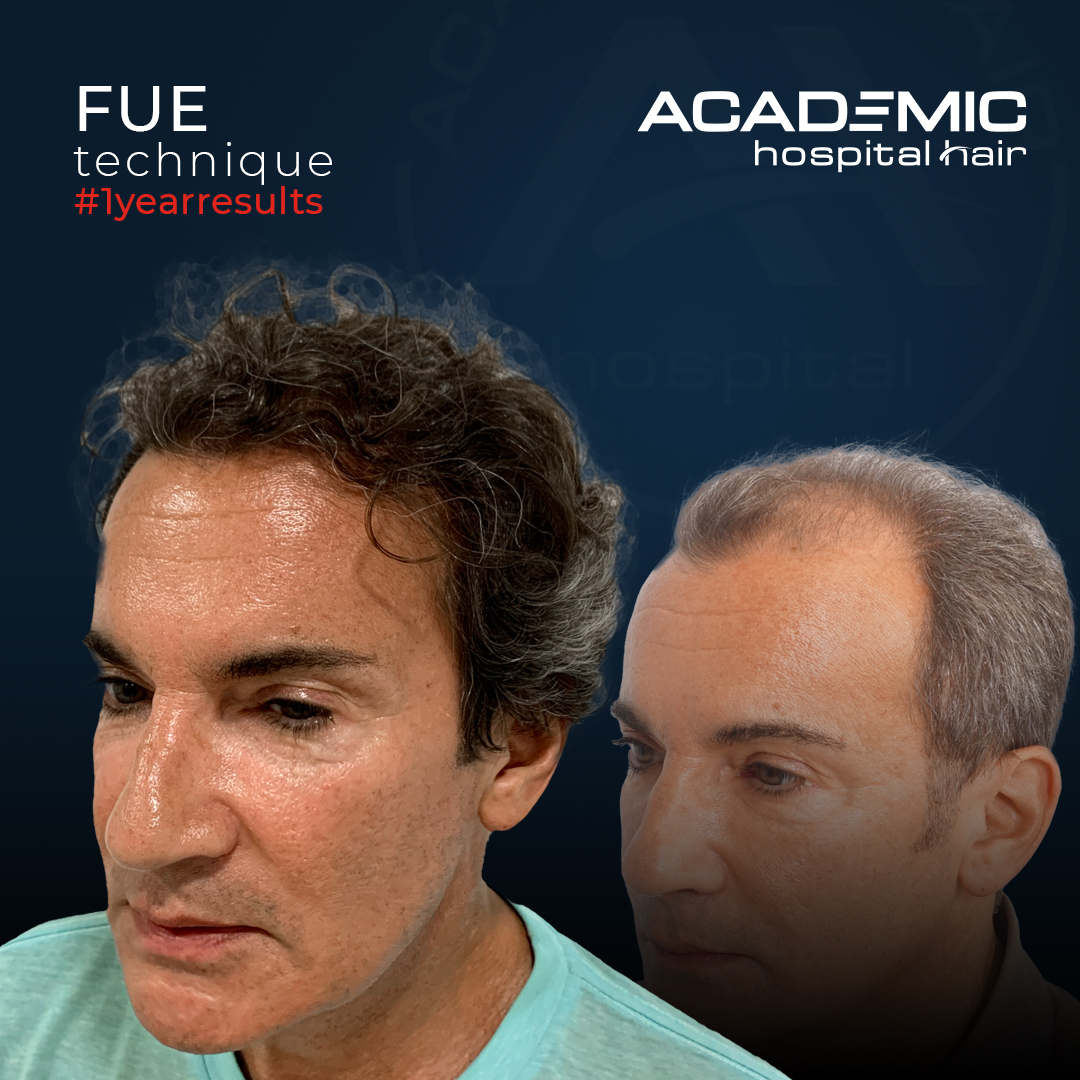 FUE — Academic Esthetics