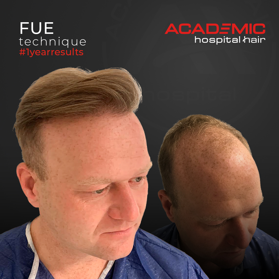 FUE — Academic Esthetics