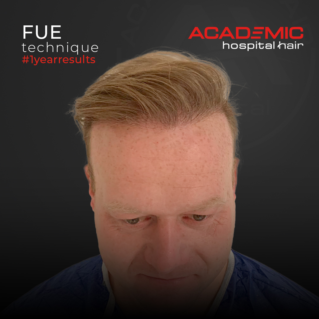 FUE — Academic Esthetics