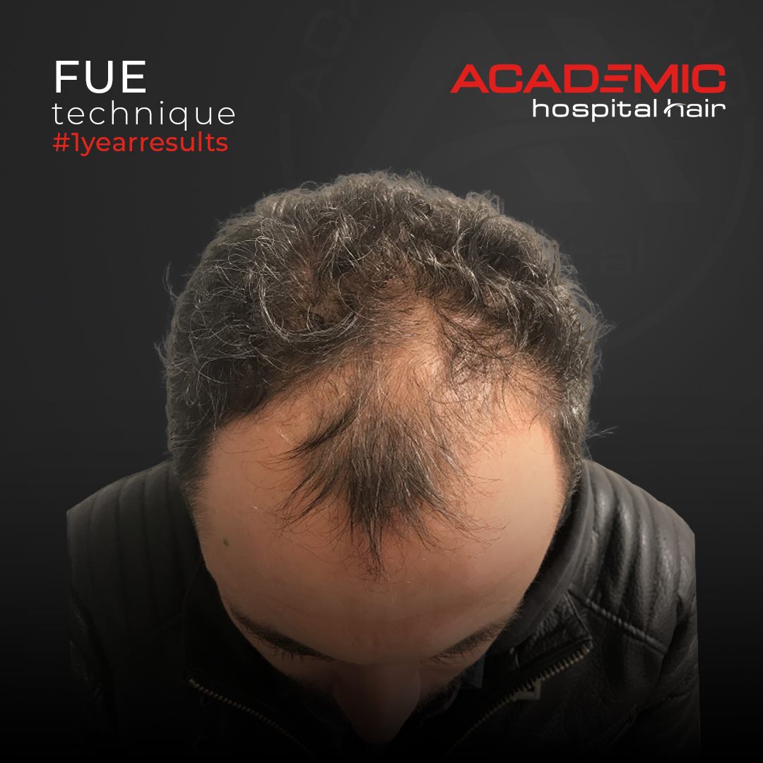 FUE — Academic Esthetics