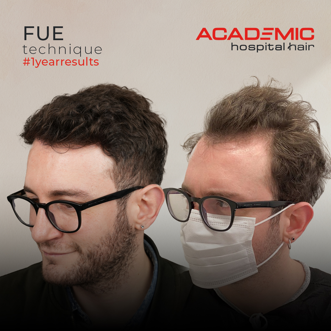 FUE — Academic Esthetics