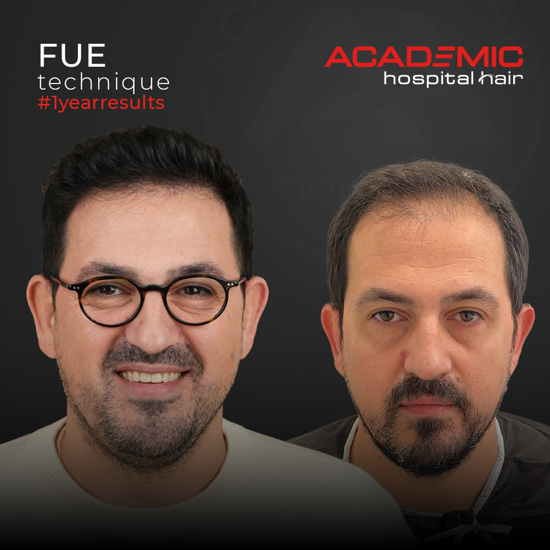 FUE — Academic Esthetics