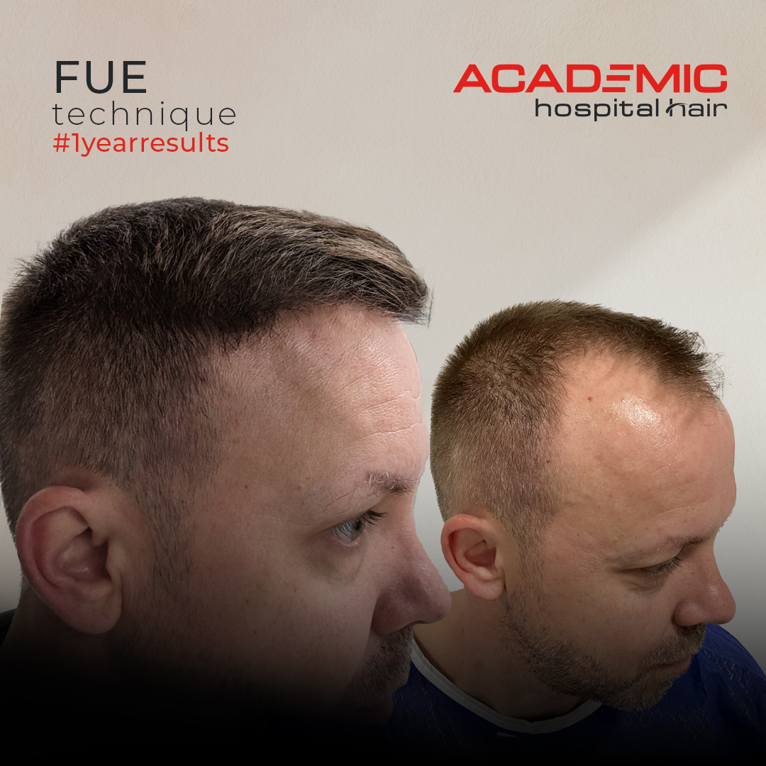 FUE — Academic Esthetics