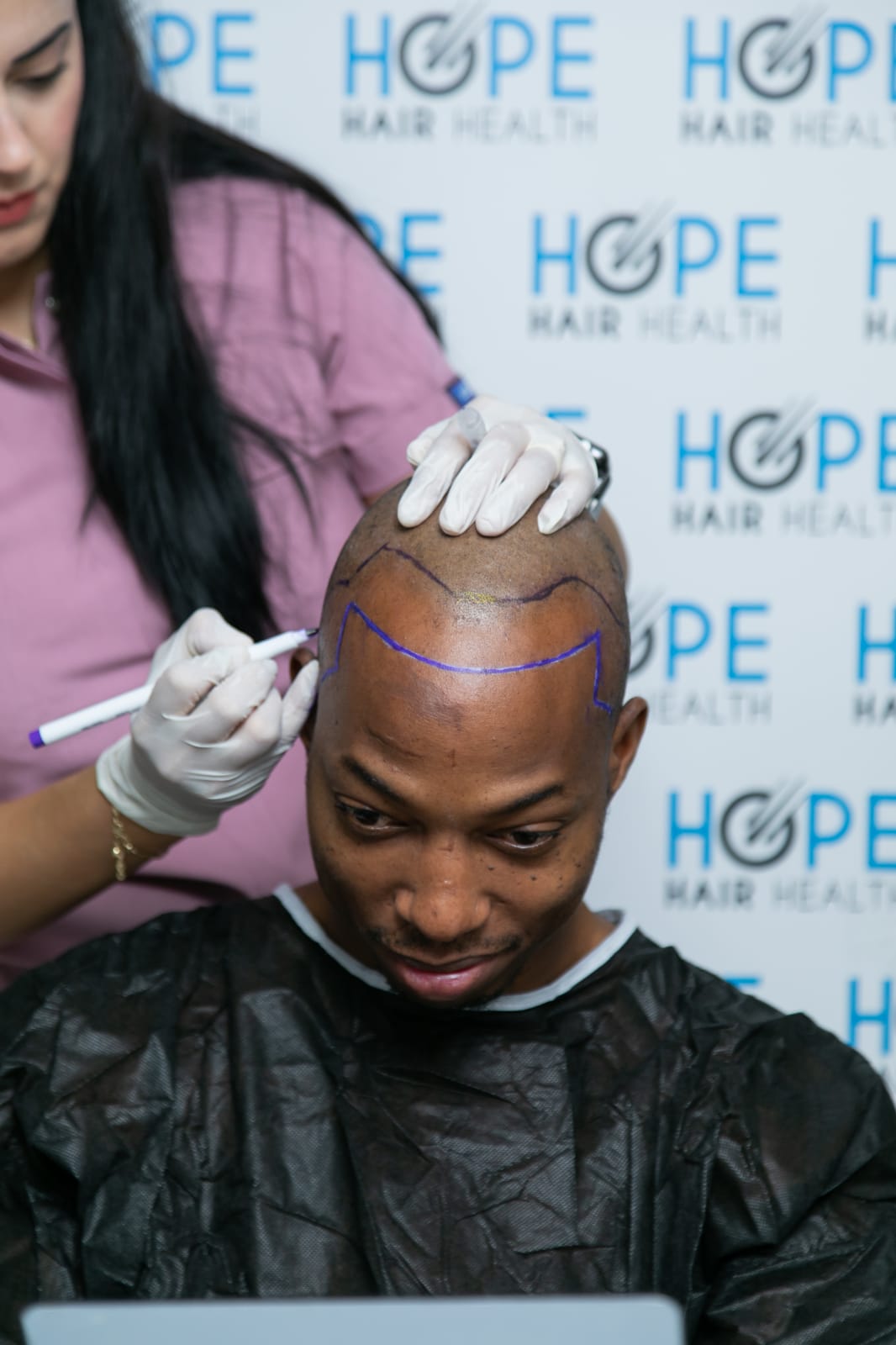 AFRO FUE — Hope Hair Health