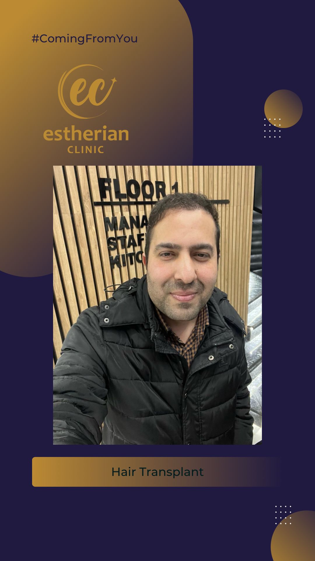 FUE — Estherian clinic