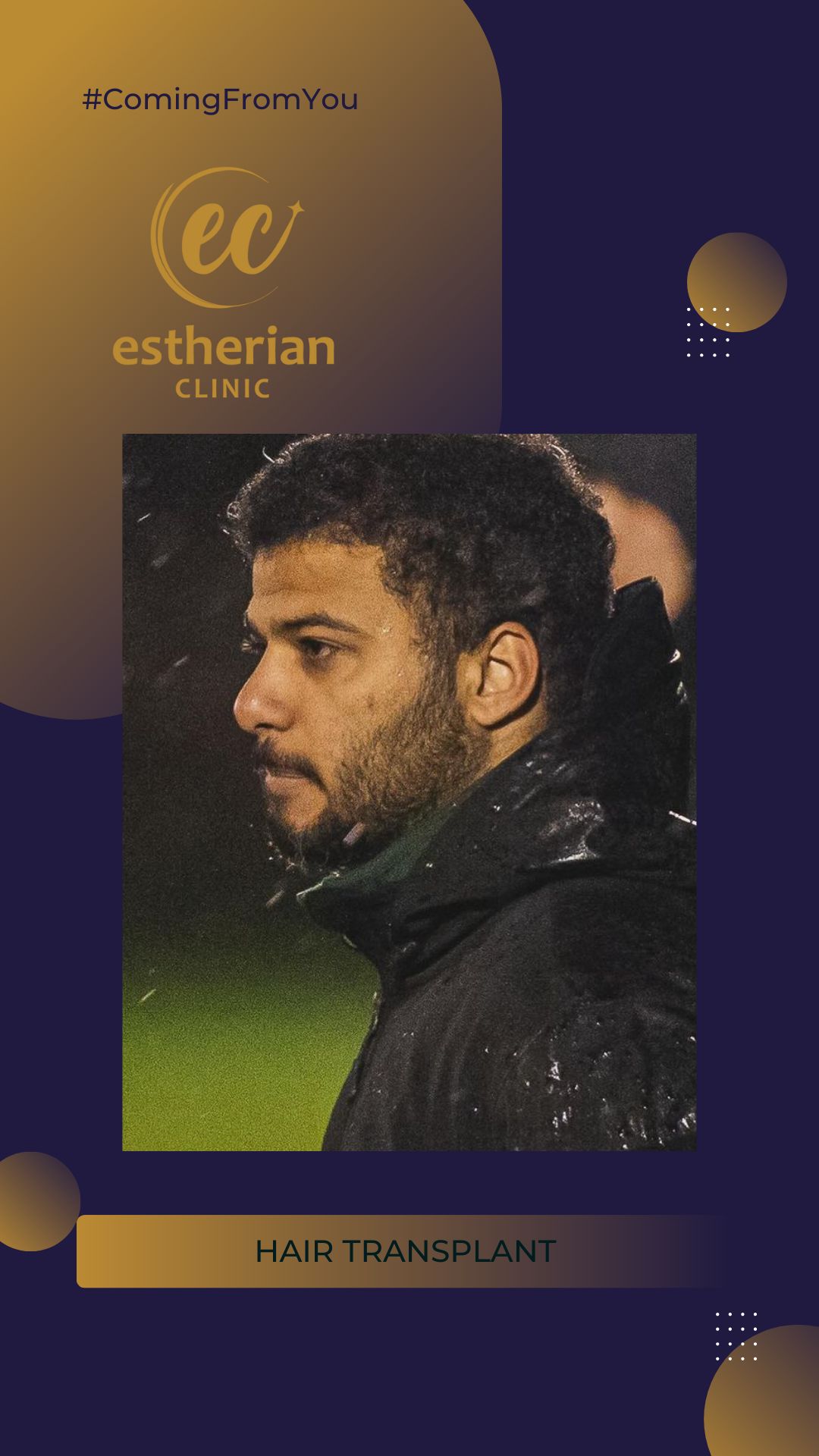 FUE — Estherian clinic
