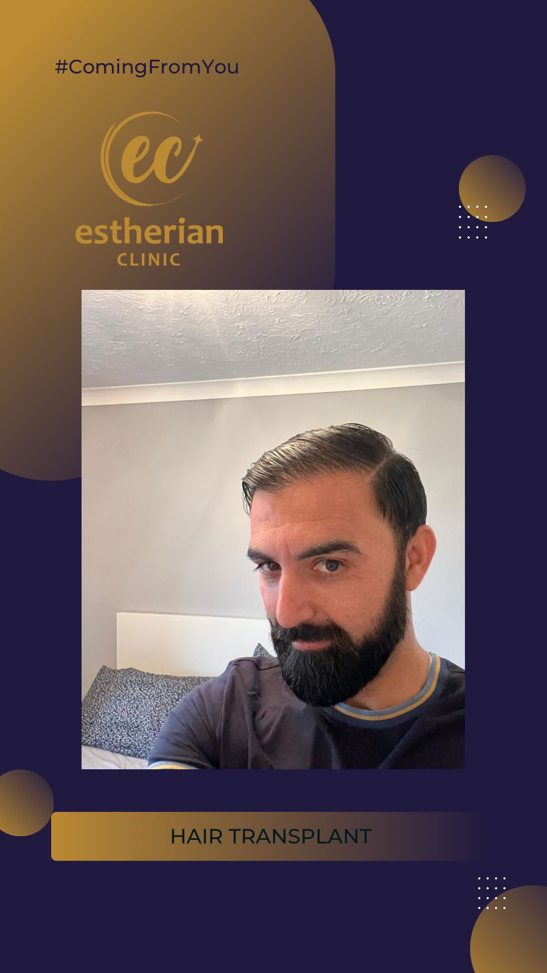 FUE — Estherian clinic
