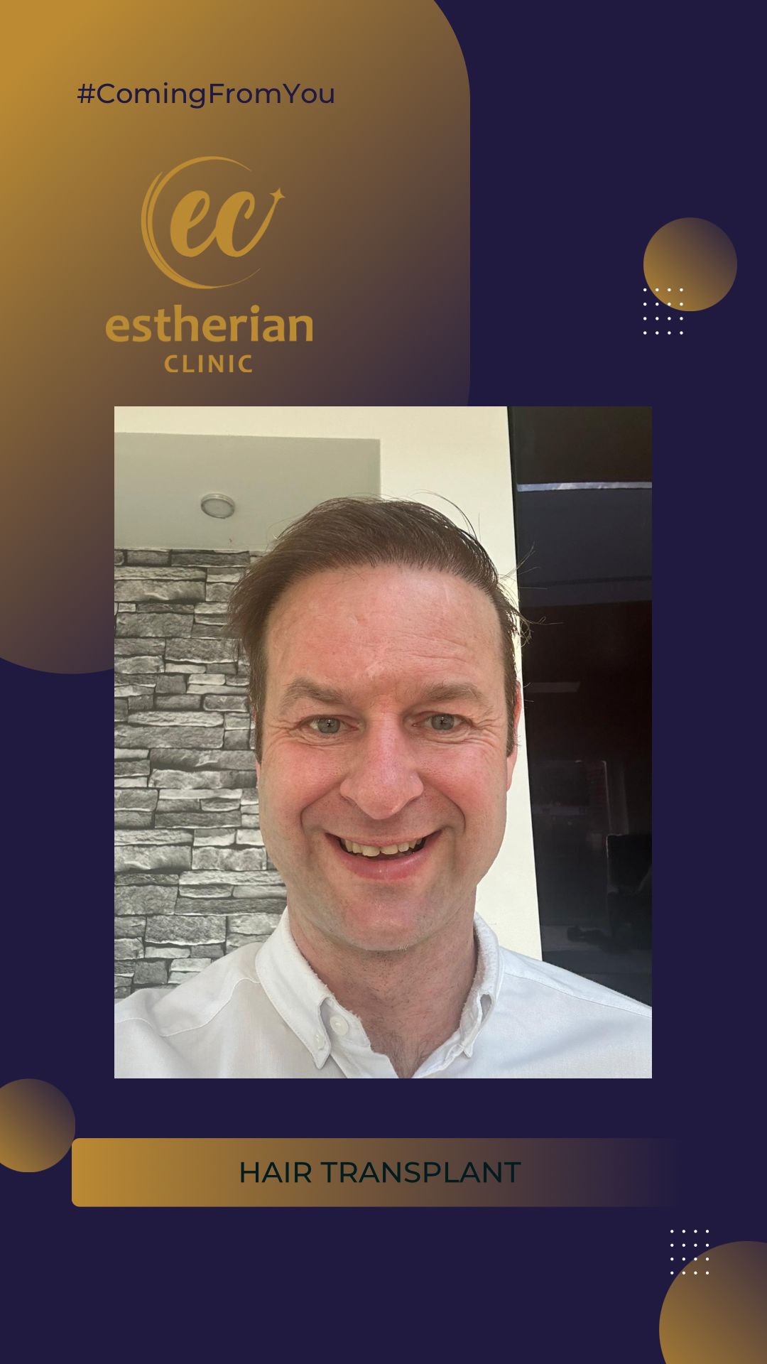 FUE — Estherian clinic