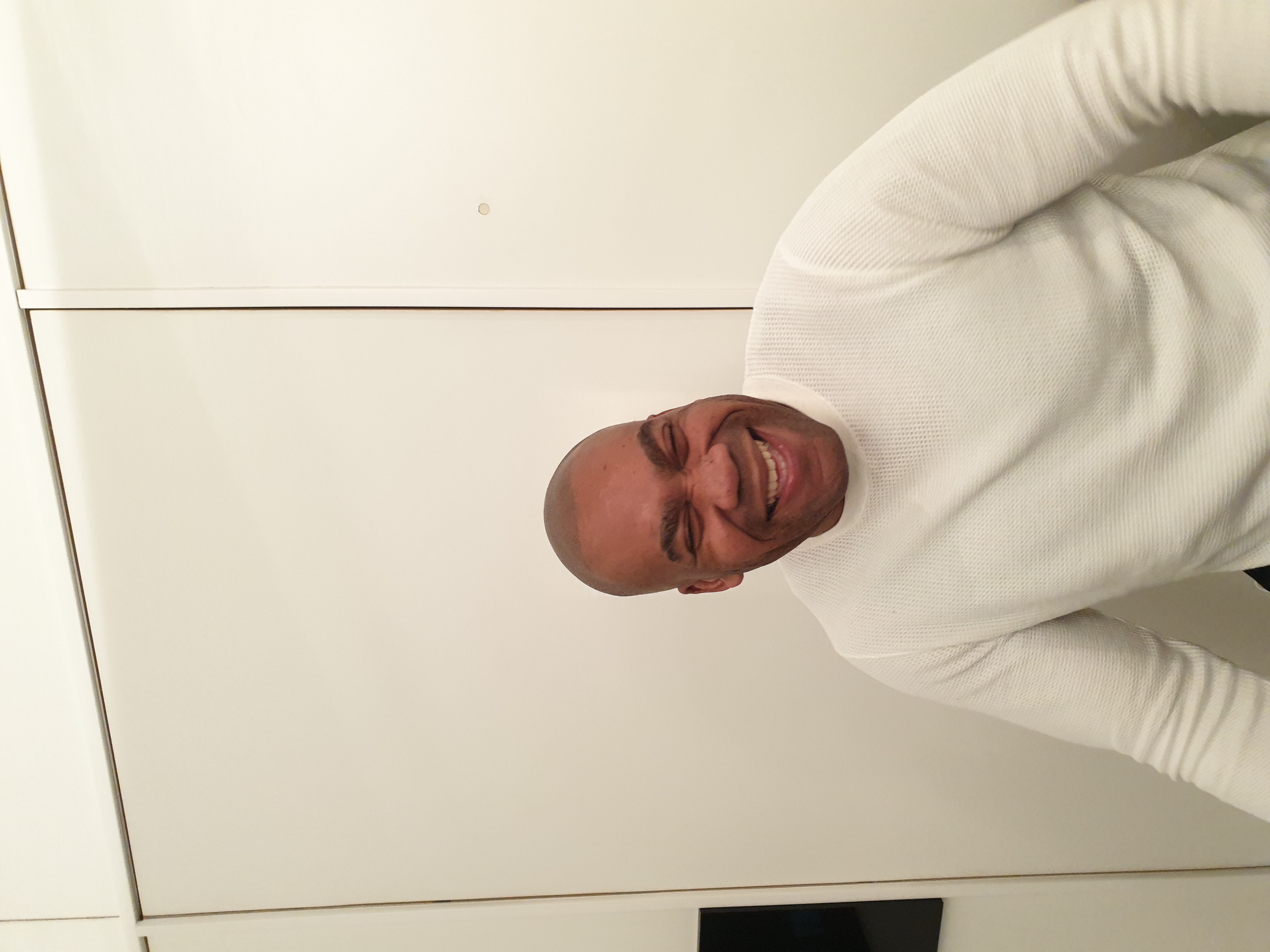 Scalp Micro Pigmentation SMP — Scalp Esthetik