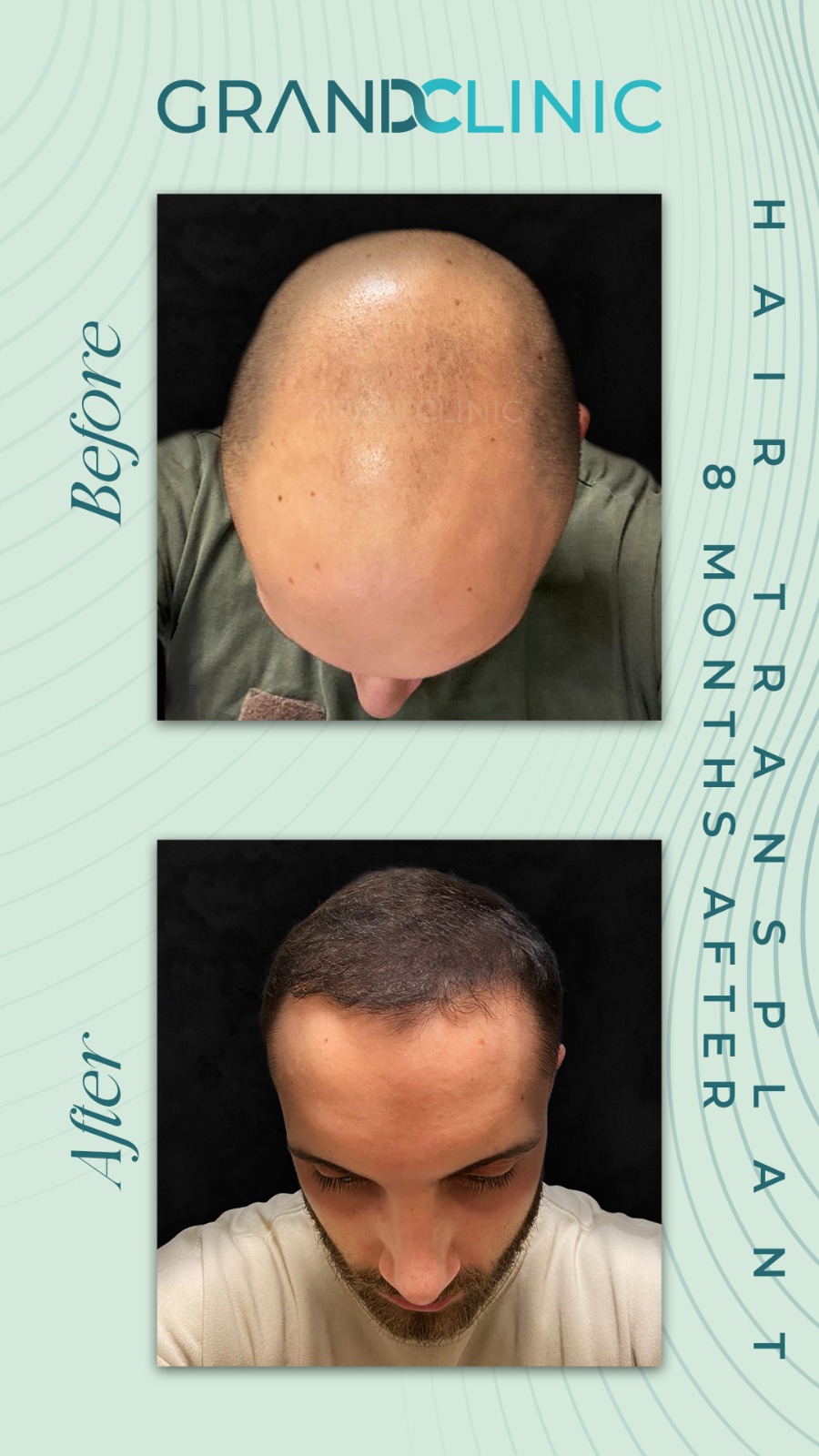 DHI — Grand Clinic