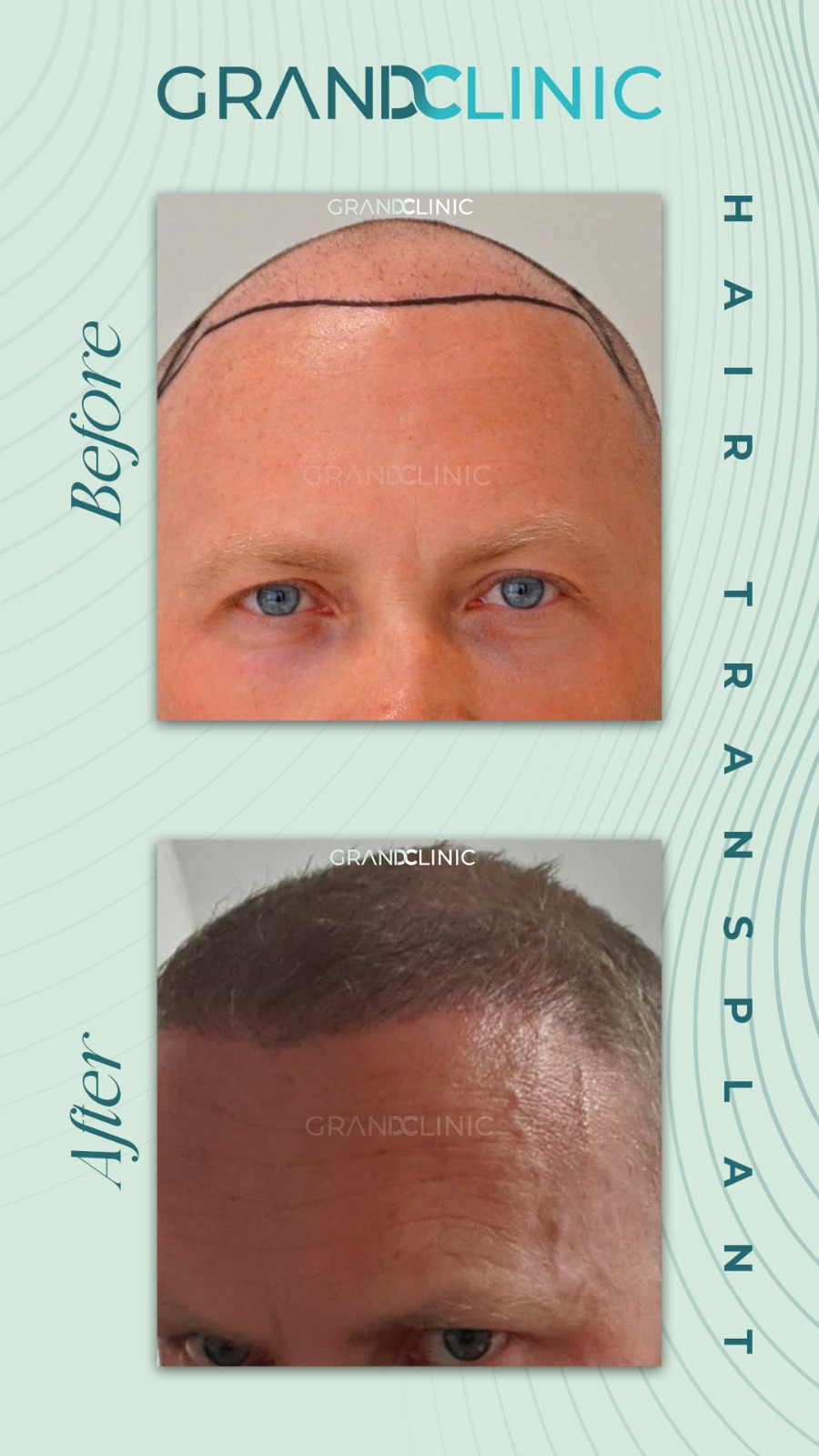 DHI — Grand Clinic