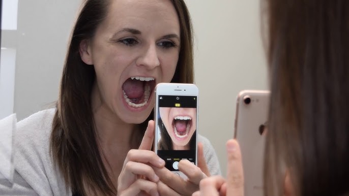 Patient sending dental photos and X-rays online for quote